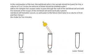 How to isolate DNA from blood by phenol chloroform