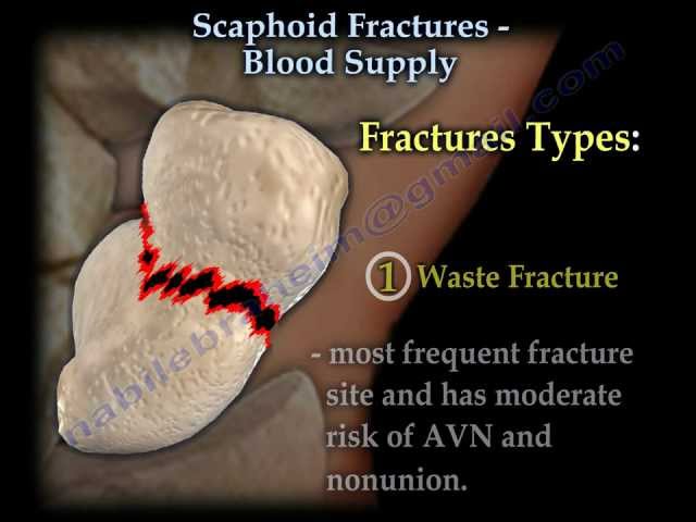 Anatomical Snuff Box - Everything You Need To Know - Dr. Nabil Ebraheim 