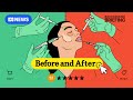 Under your skin | Before and After - Episode 3 | BB investigates the injectable industry