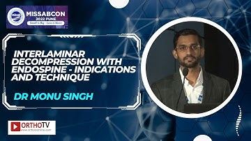 Is 2D Fluoroscopy Reliable   Evaluation of Perforation indices in MIS TLIF - Dr Mukul Jain