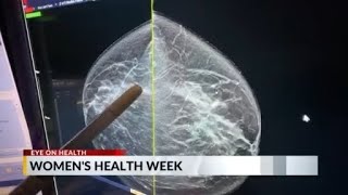 Breast health experts discussing mis-information delaying cancer detection