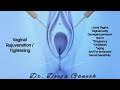 Vagina tightening animation  drdeepa ganesh  cosmetic gynecologist chennai