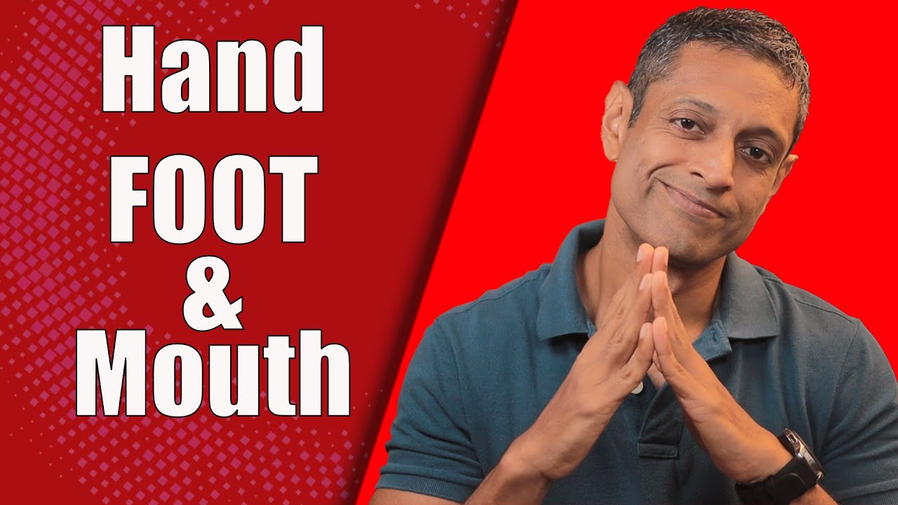 Hand Foot and Mouth Disease Symptoms Clearly Explained