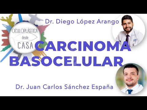 Vídeo: Seguridad Y Eficacia De Vismodegib En Pacientes Con Síndrome De Nevo De Carcinoma Basocelular: Análisis Agrupado De Dos Ensayos