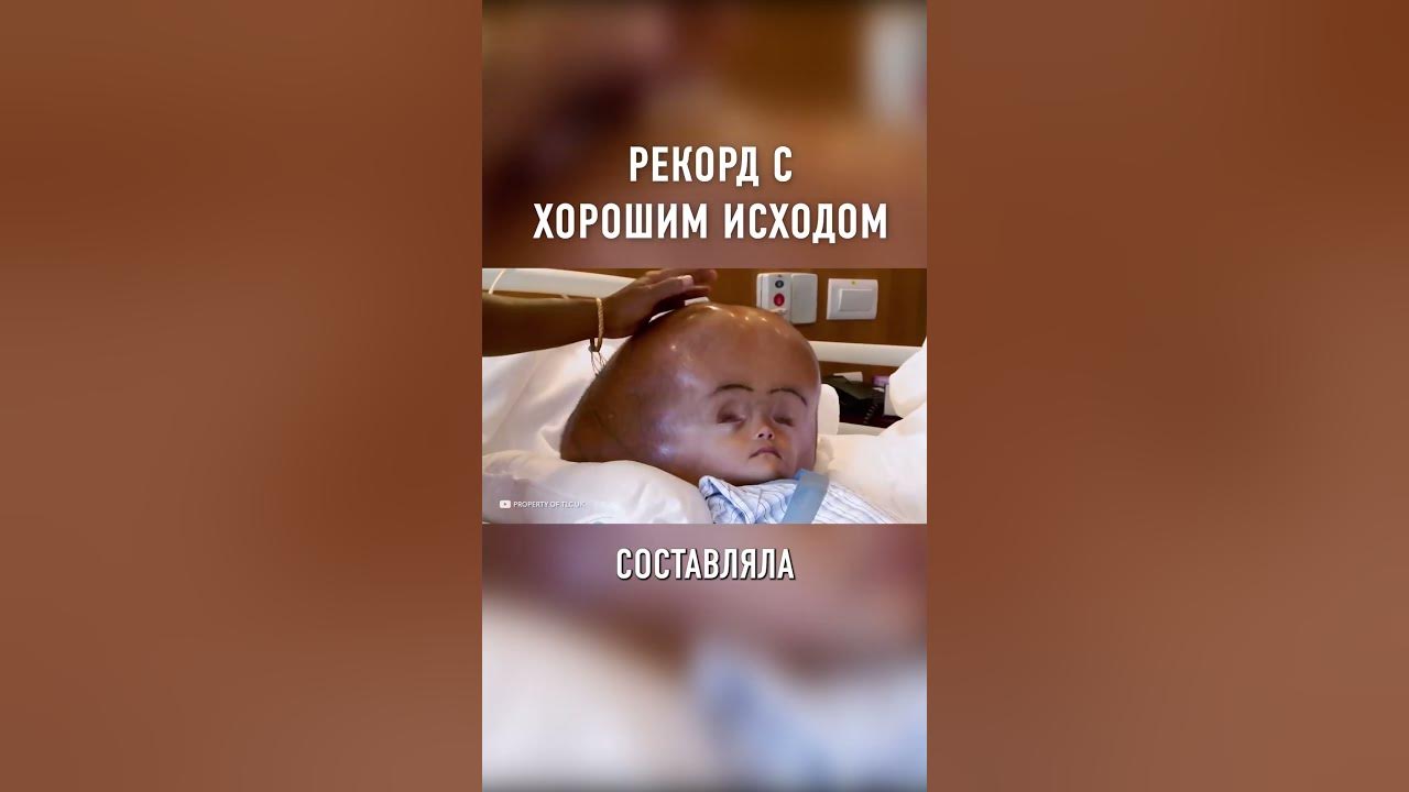 ГОЛОВА — ПОЧТИ МЕТР Самая БОЛЬШАЯ Голова в МИРЕ #shorts - YouTube