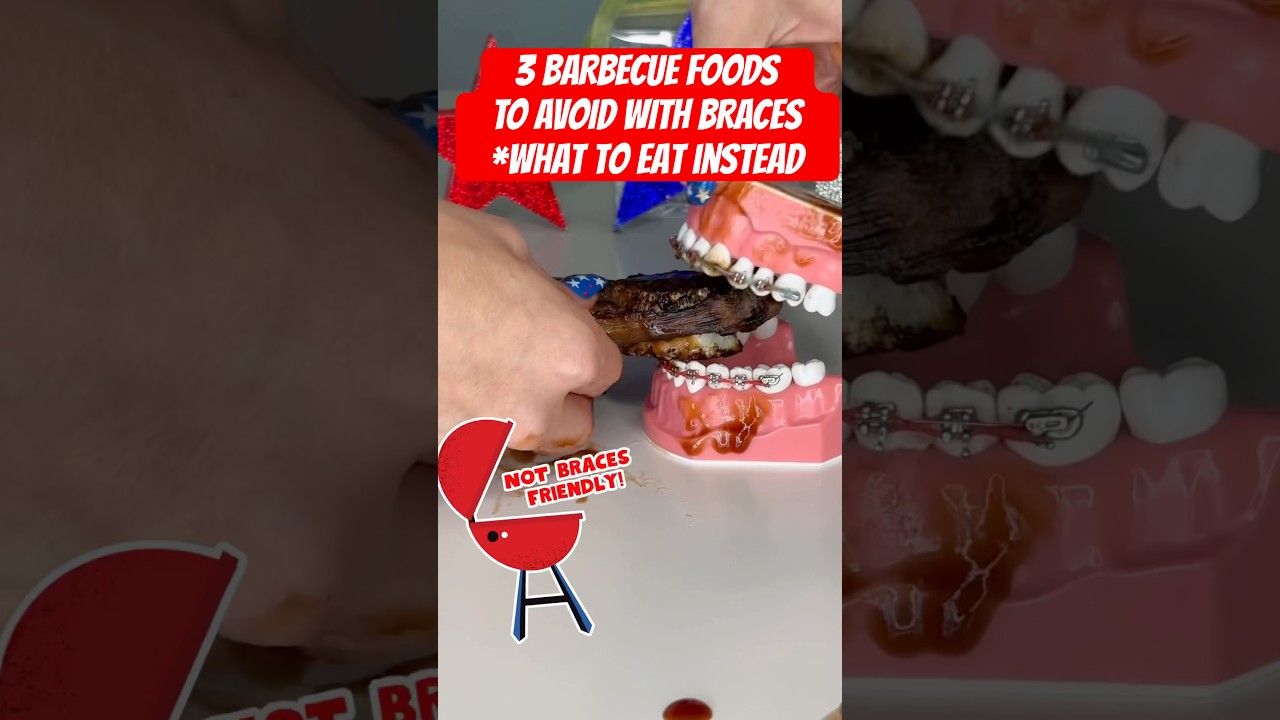 3 BARBECUE FOODS TO AVOID WITH BRACES *what to eat instead 