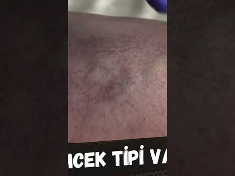 BU BELİRTİLER VARSA
