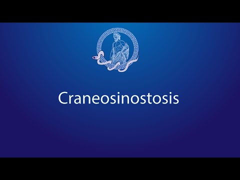 CRANEOSINOSTOSIS