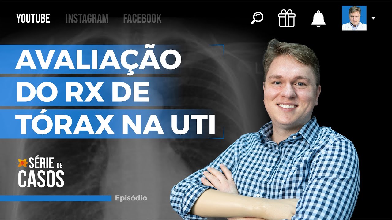 RADIOGRAFIA DE TÓRAX NA UTI - O QUE O MÉDICO PRECISA SABER