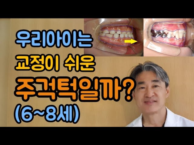 턱에 문제가 있는 주걱턱과 치아배열에 문제가 있는 주걱턱을 구별하는 법!