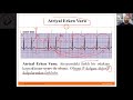 Prematüre Ventriküler Kompleks (PVC), Prematüre Atrial Complex (PAC)