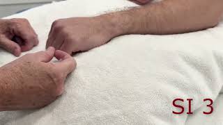 McMaster Medical Acupuncture Program: SI 3 Point Demonstration