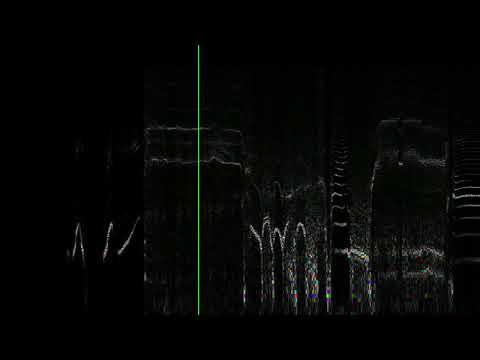 C418 disc 999999999999999999999999999 (Meme) #spectrometer (Spectrogram) 