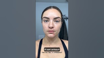 How my face changed with 8 days no alcohol #dryjanuary #sober #sobriety #shortsvideo #shorts