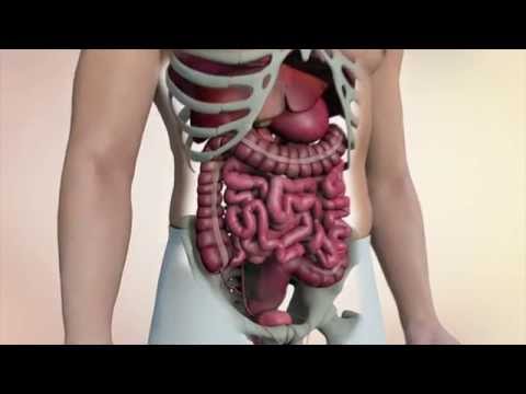 Colon cancer: Essential facts