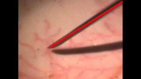 Active Testing Filtering for Retinal Microsurgery