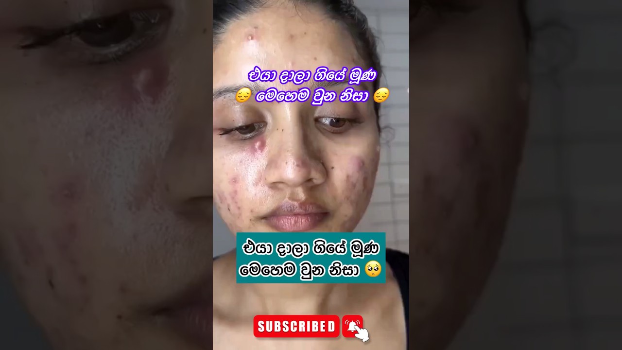 දෙපාරක් බලන්න ඔට්ටු නෑ ලමයෝ 🥰🌸 