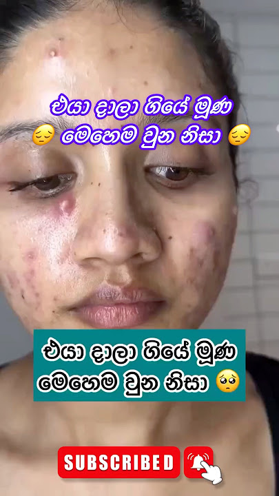 දෙපාරක් බලන්න ඔට්ටු නෑ ලමයෝ 🥰🌸 #trending #viral #tiktok #short #srilanka #shorts #shortsfeed