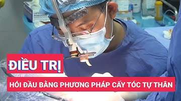 Cẩn trọng khi điều trị hói đầu bằng phương pháp cấy tóc tự thân