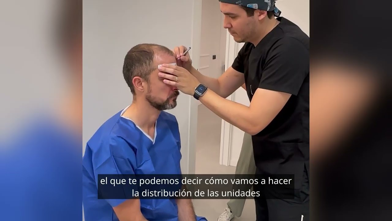 Qué vamos a ver en mi primera consulta para el injerto capilar — Doctor Merlos