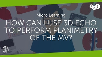 How can I use 3D echo to perform planimetry of the MV?