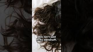 Why You Should NEVER Sleep With Wet Hair (Science Explained) #shorts