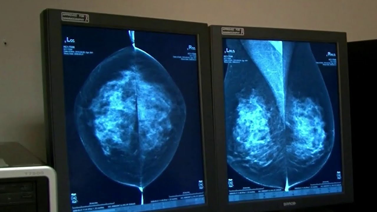 These are the health tests you should start getting at age 50 YouTube