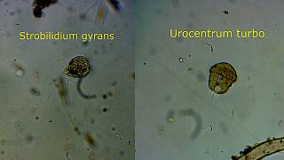Strobilidium vs Urocentrum: Dos trompos microscópicos.