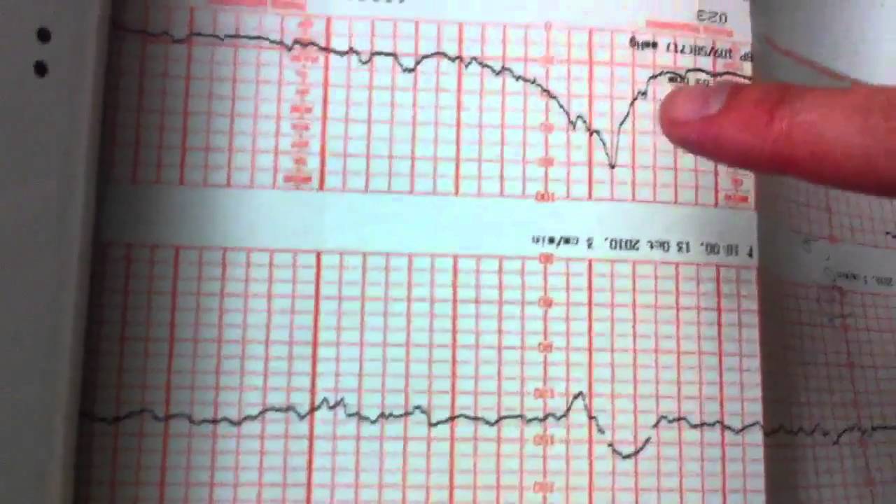 Heart monitor YouTube
