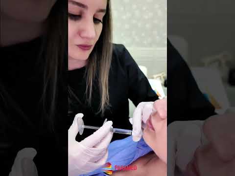 Təbii dolğu ilə çənə korreksiyası