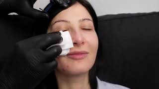 How To Hold Gauze | Botox & Dermal Fillers |Advanced Facial Aesthetics