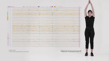 Soterix  Medical Presents SMARTING mobi: EEG artifacts removal with ASR