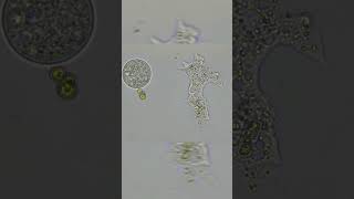Two Stages Of Amoeba
