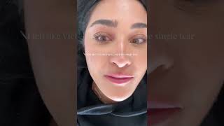 Round 2 Lip Filler ♥️😘 #lipfiller #lipfillers #vlog