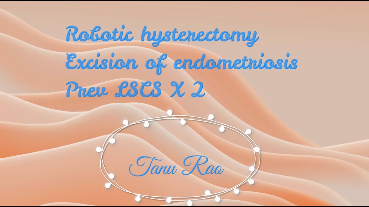 Robotic hysterectomy with excision of superficial endometriosis - YouTube
