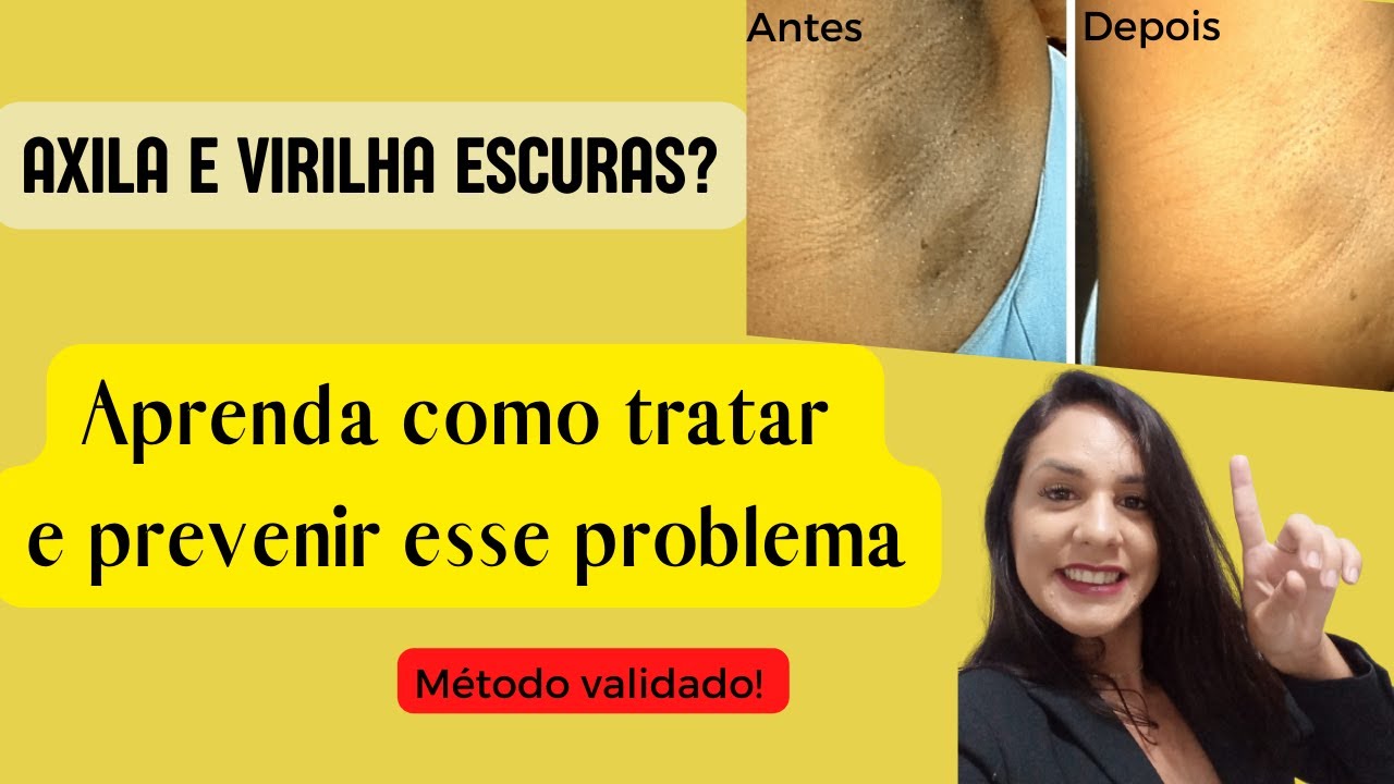 como clarear axila e virilha escura - YouTube