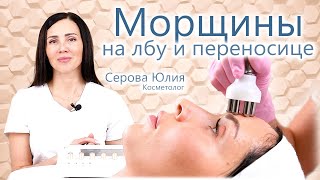видео: 🔬Убираем морщины на лбу и переносице. 🙌Смотрим эффект ДО и После. 🐱🏍Глубокие морщины - не проблема! картинка: 🔬Убираем морщины на лбу и переносице. 🙌Смотрим эффект ДО и После. 🐱🏍Глубокие морщины - не проблема!