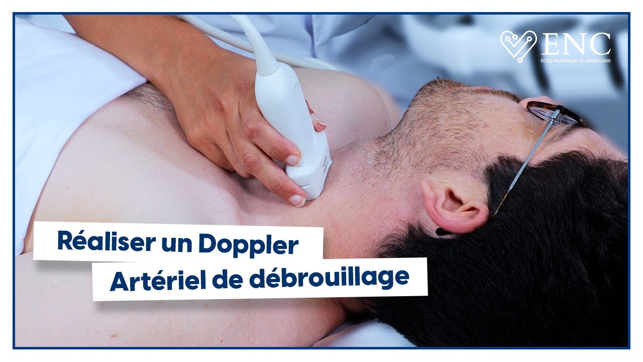 Tuto ENC : comment faire un doppler artériel de débrouillage ?