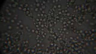 Yeast under microscope 100x Under The Microscope Active Yeast Cell 100x 400x