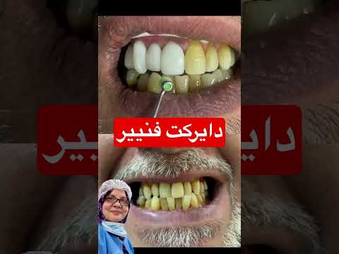 افضل مركز اسنان في اربيل افضل عياده اسنان في اربيل