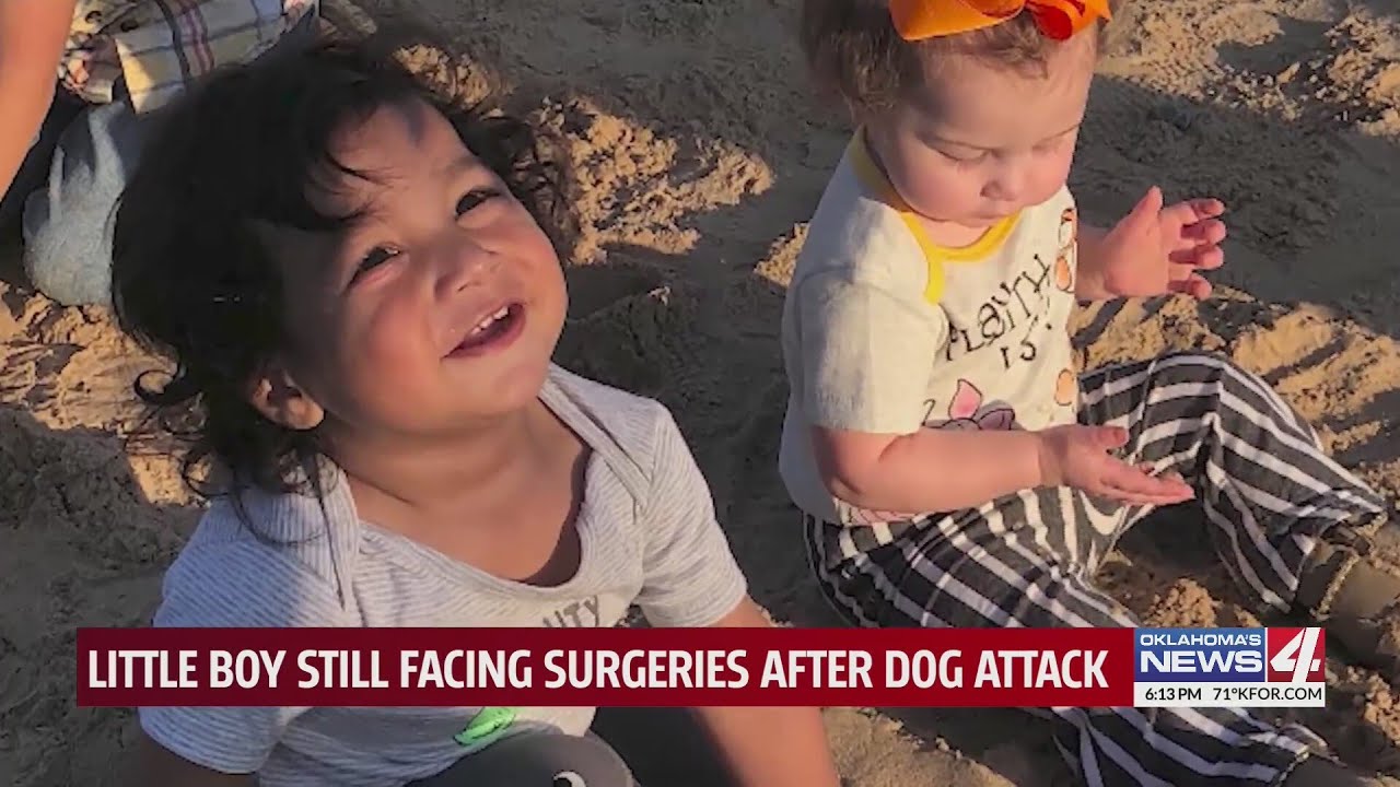 Little boy still facing surgeries after dog attack - YouTube