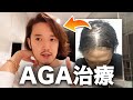 【全ハゲ(薄毛)男性に送る】AGA治療について本当のことを話そう。