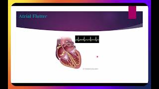 Atrial Rhythms