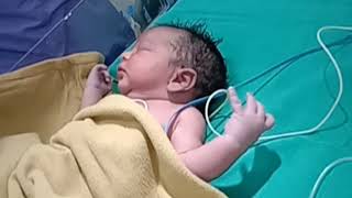 Newborn Baby C-Section Delivery Crying Baby Birth