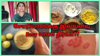 Psoriasis treatment in Tamil |permanent psoriasis treatment| Tamil | Devi