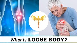 What Is A Loose Body? Knee
