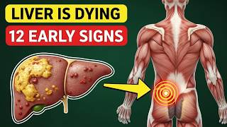 7 Warning Signs of Fatty Liver You’re Probably Ignoring (Number 5 is Shocking)