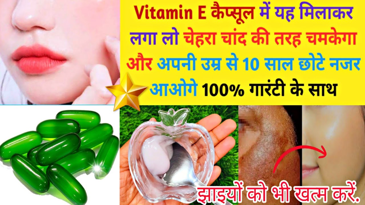 HOW TO USE VITAMINE E CAPSULES BENEFITS IN HINDI Remove pigmentation
