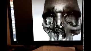 variable detail point cloud rendering of skull