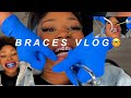 Braces Vlog 🤓 | N’finidii